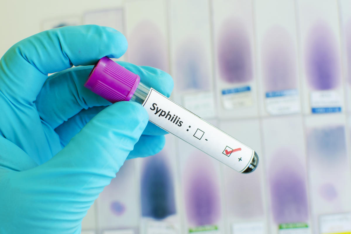 Syphilis caes are on the rise. The fda just approved a home test that coulud combat that.