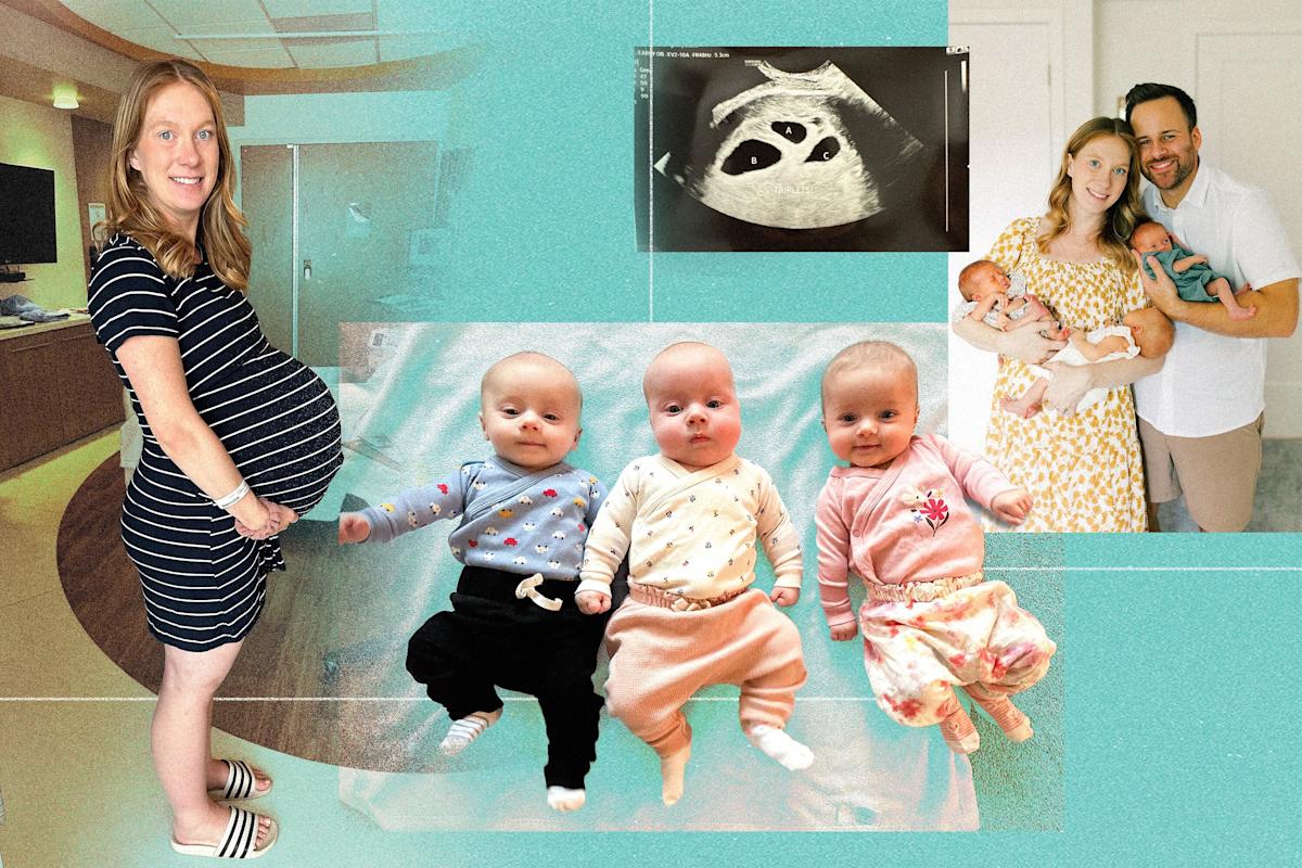 She has 2 uteruses. Then she had triplets. Her case is rare – and has puzzled doctors.