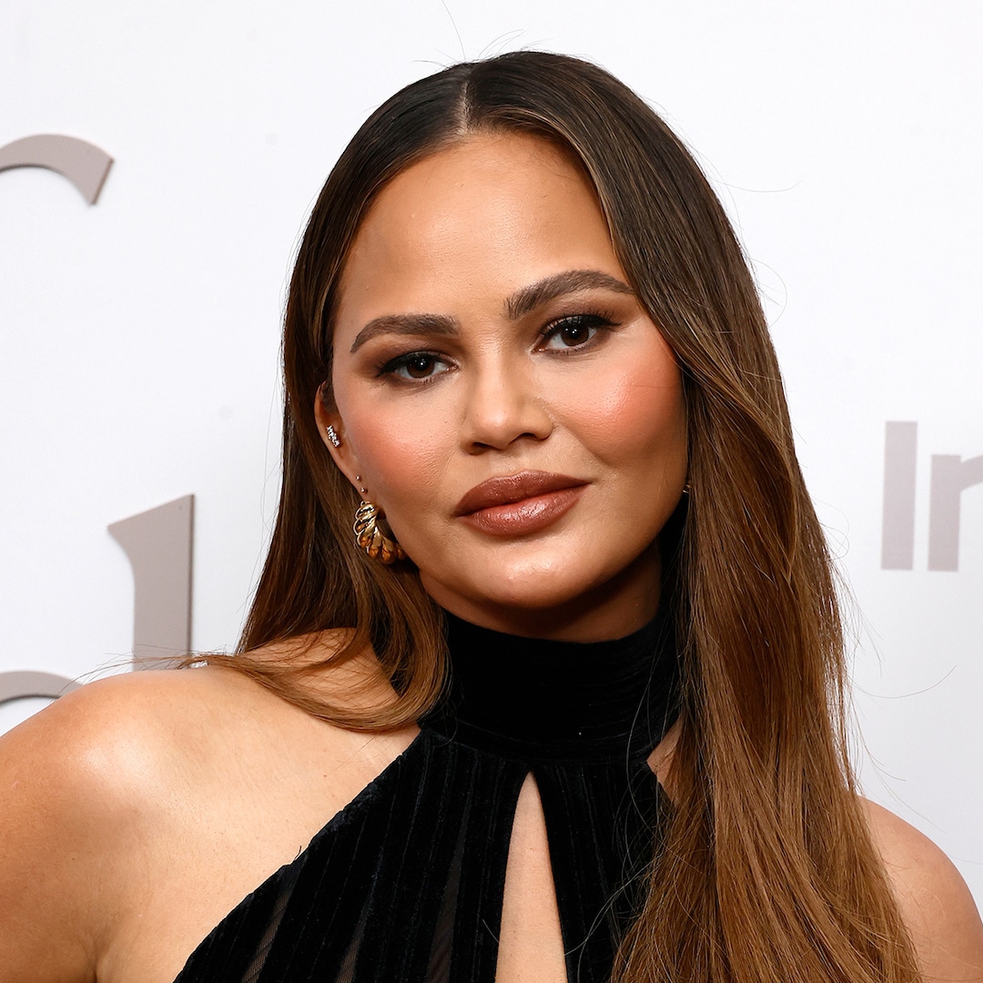 Chrissy Teigen Reveals Photo from Hairline Lowering Procedure